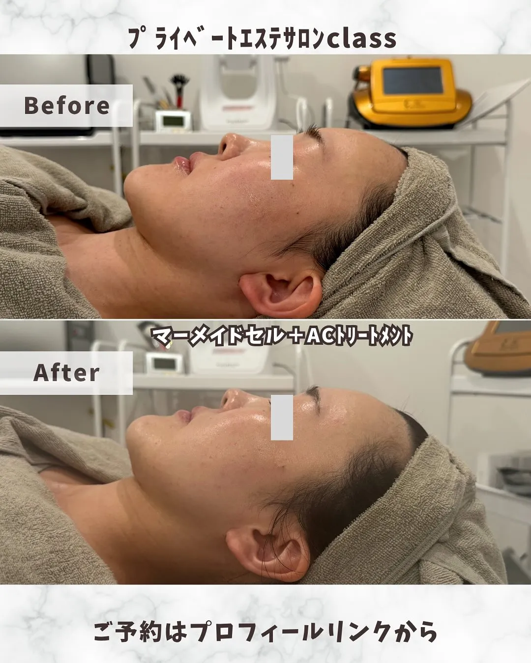 プライベートエステサロンClassです
