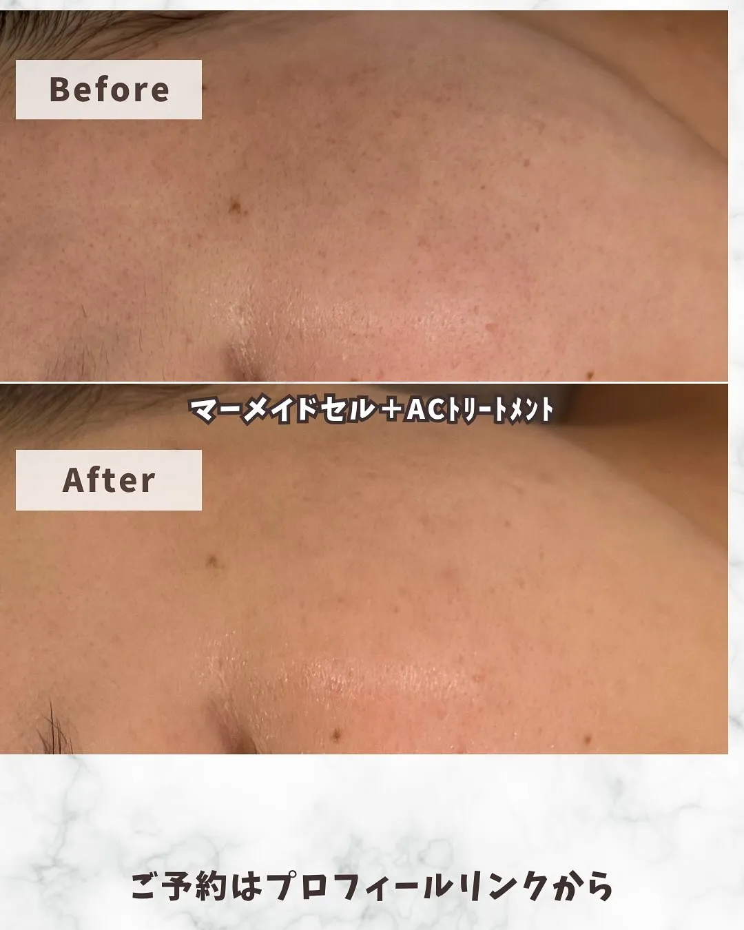 プライベートエステサロンClassです