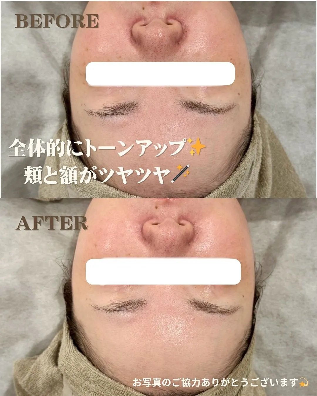 ACトリートメント🌿