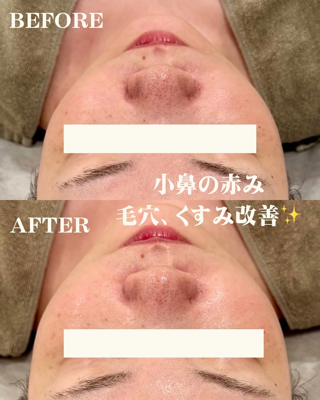 ACトリートメント🌿