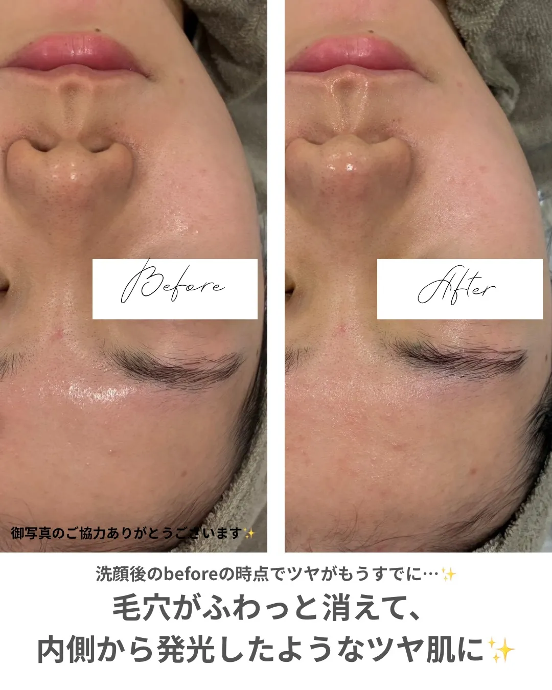 【マーメイドセル🪸✨】