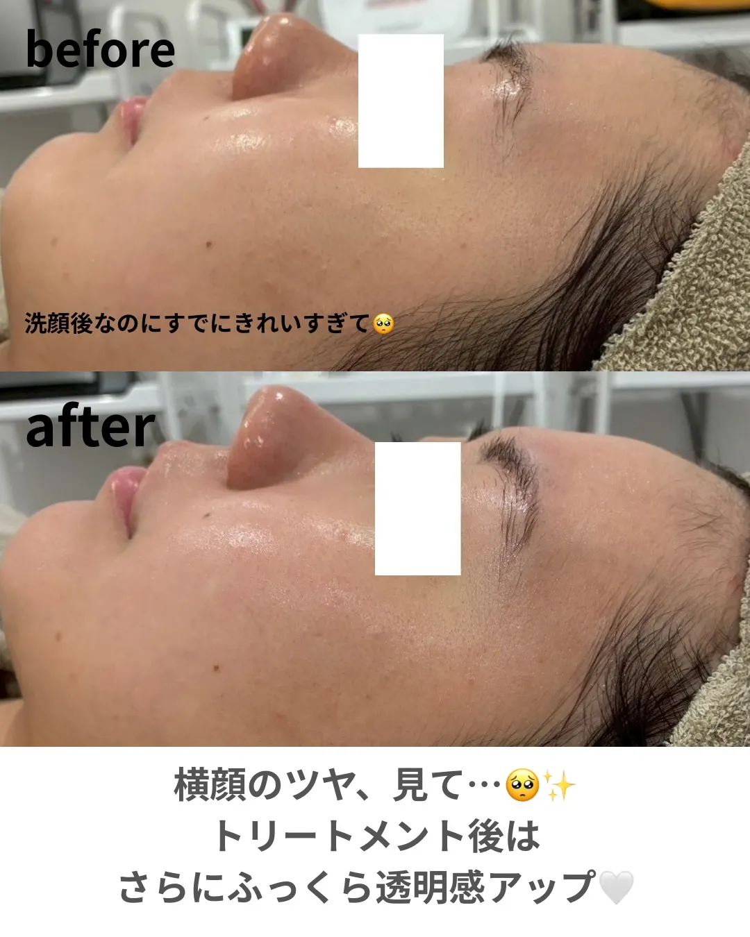 【マーメイドセル🪸✨】