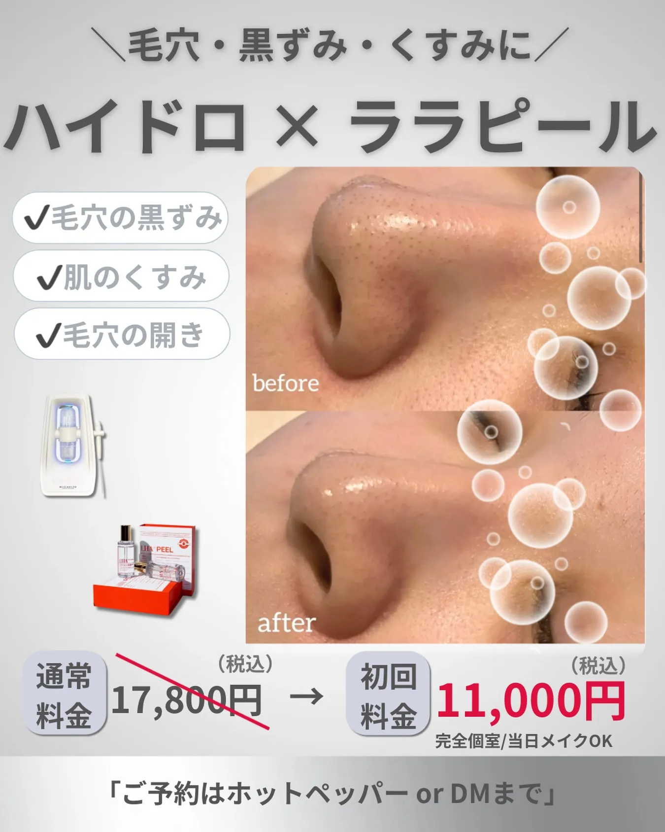 毛穴・黒ずみ・くすみが気になる方へ。