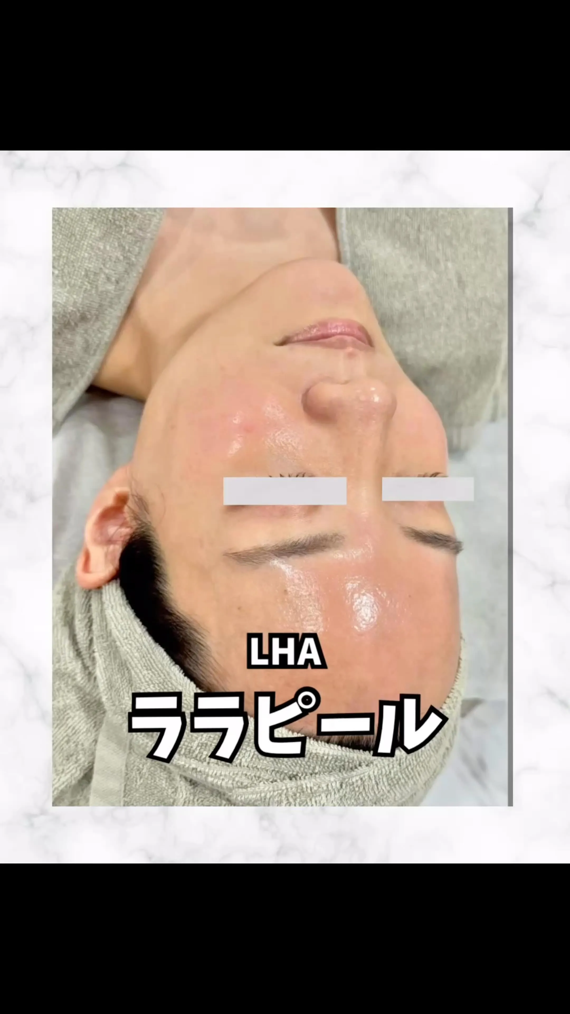 🌿大人気ララピールで透明感UP🌿