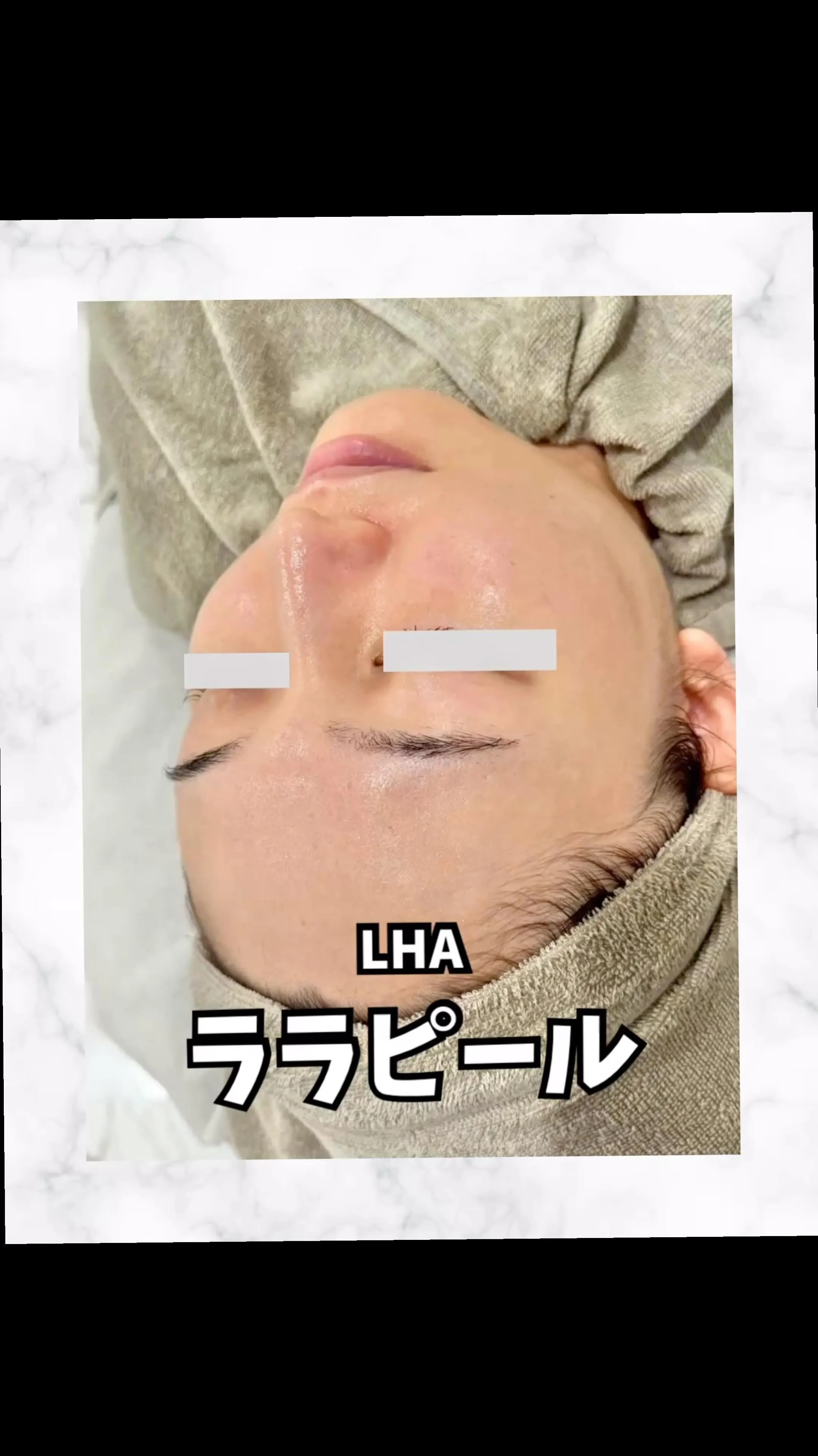💐エステサロンってどのくらい通えばいいの？