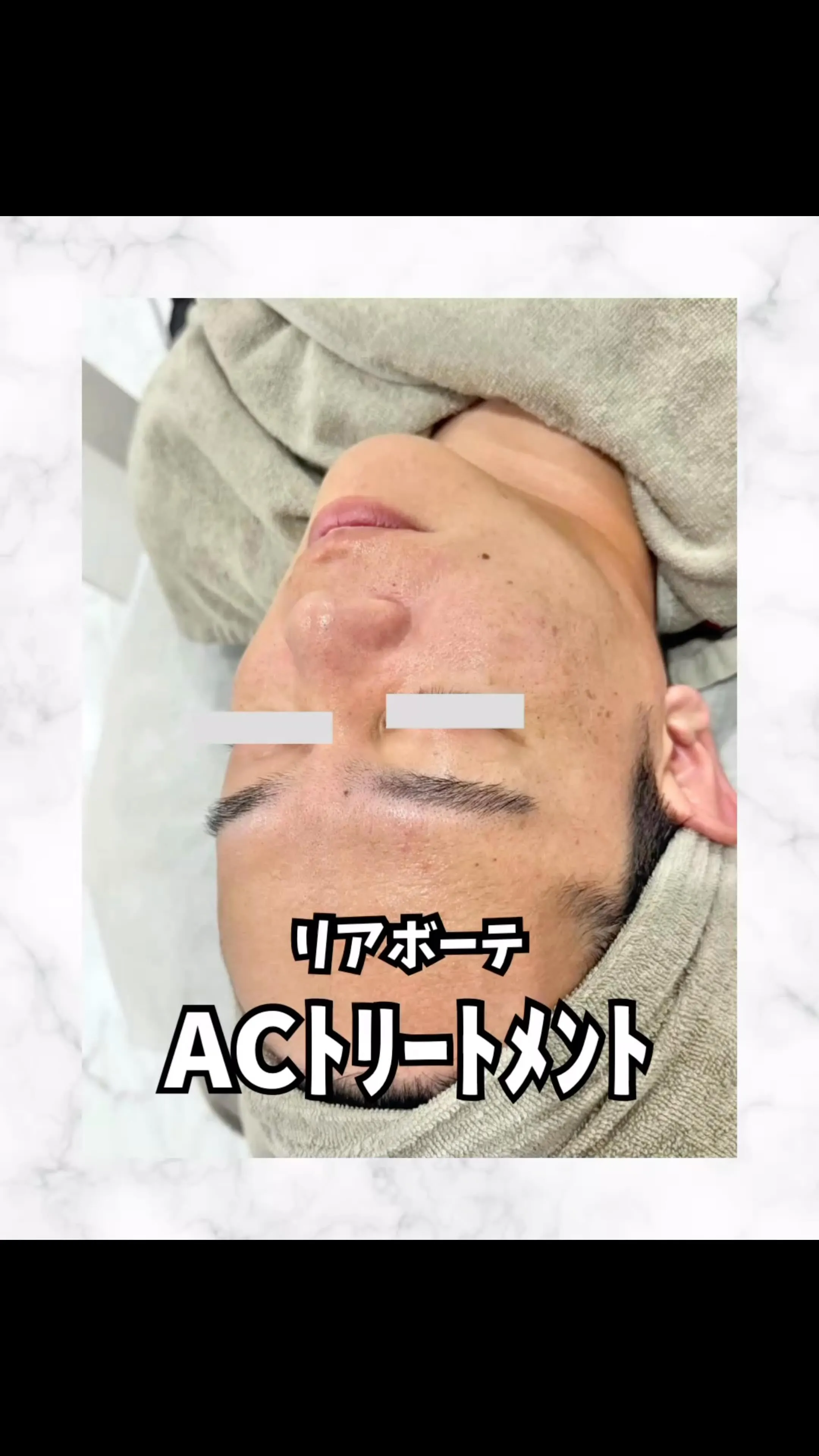 男性もACフェイシャルトリートメントで日頃の肌疲れをケアしま...