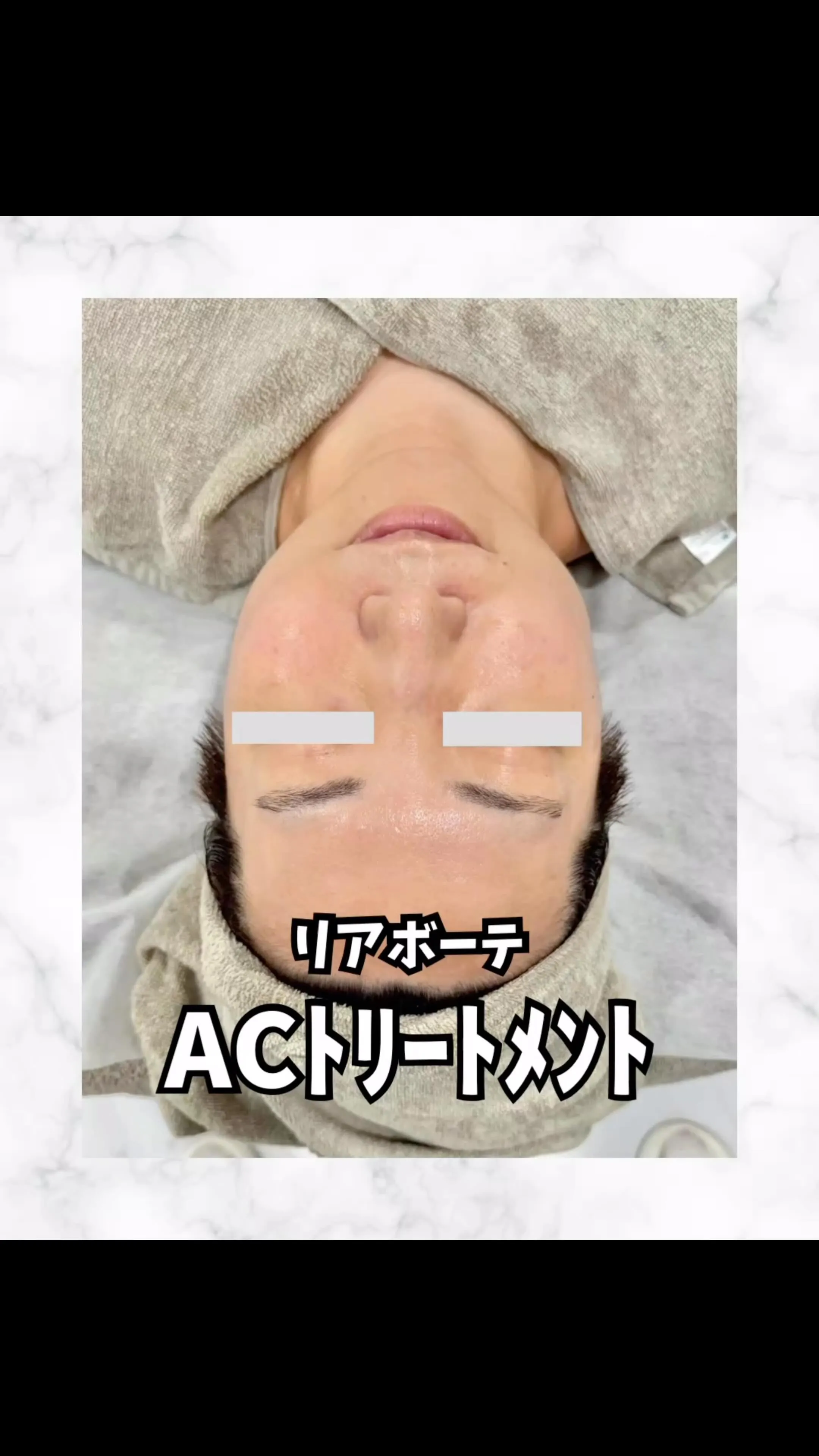 🍉夏こそお肌のケアを入念にしましょう！！
